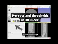 3D Slicer - Presets and thresholds