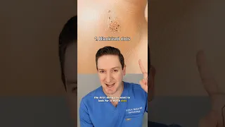 Dermatologist explains how to tell if you have a wart