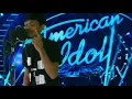 Download Lagu Varal❗sakit gigi indonesian idol valdy nyonk memukau para juri