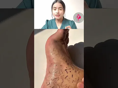 Face and body tan removal scrub #tanremoval#facetanremoval#bodytan#ytshorts