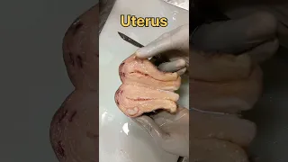 Real Human Uterus 