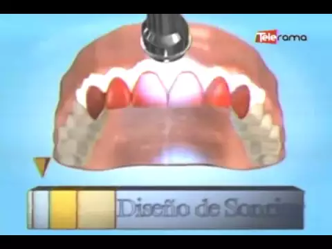 Diseño de Sonrisa