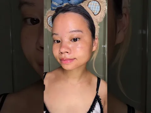 When her relatives asked her to go without makeup, then her condition