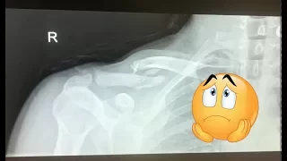 Boat improvements with a broken collarbone – Sailing Australia – Learning By Doing Ep 61