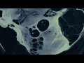 Video di The Strain (Season 3) | Official Opening Credits