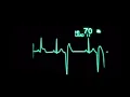 Download Lagu Suara Monitor ICU Kritis - Berhenti