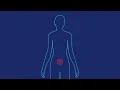 In-Clinic Abortion Planned Parenthood