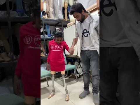 Artificial leg user / #prosthetics #heelpain #backpain #shorts #viralvideo #shortsfeed #hassanzarar