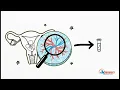 Chorionic Villus Sampling CVS Explained Nursing Students NCLEX Review Early Genetic Testing