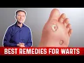 4 Best Wart Removal Remedies - Dr Berg on Wart Treatment at Home