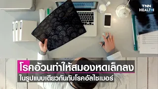  โรคอ้วนสามารถทำให้เกิดความเสียหายที่สมองได้อย่างไร 