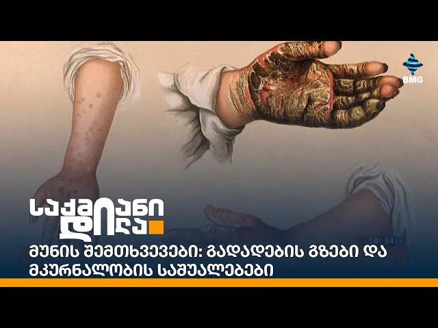 რა არის მუნი და როგორია მისი გავრცელება?