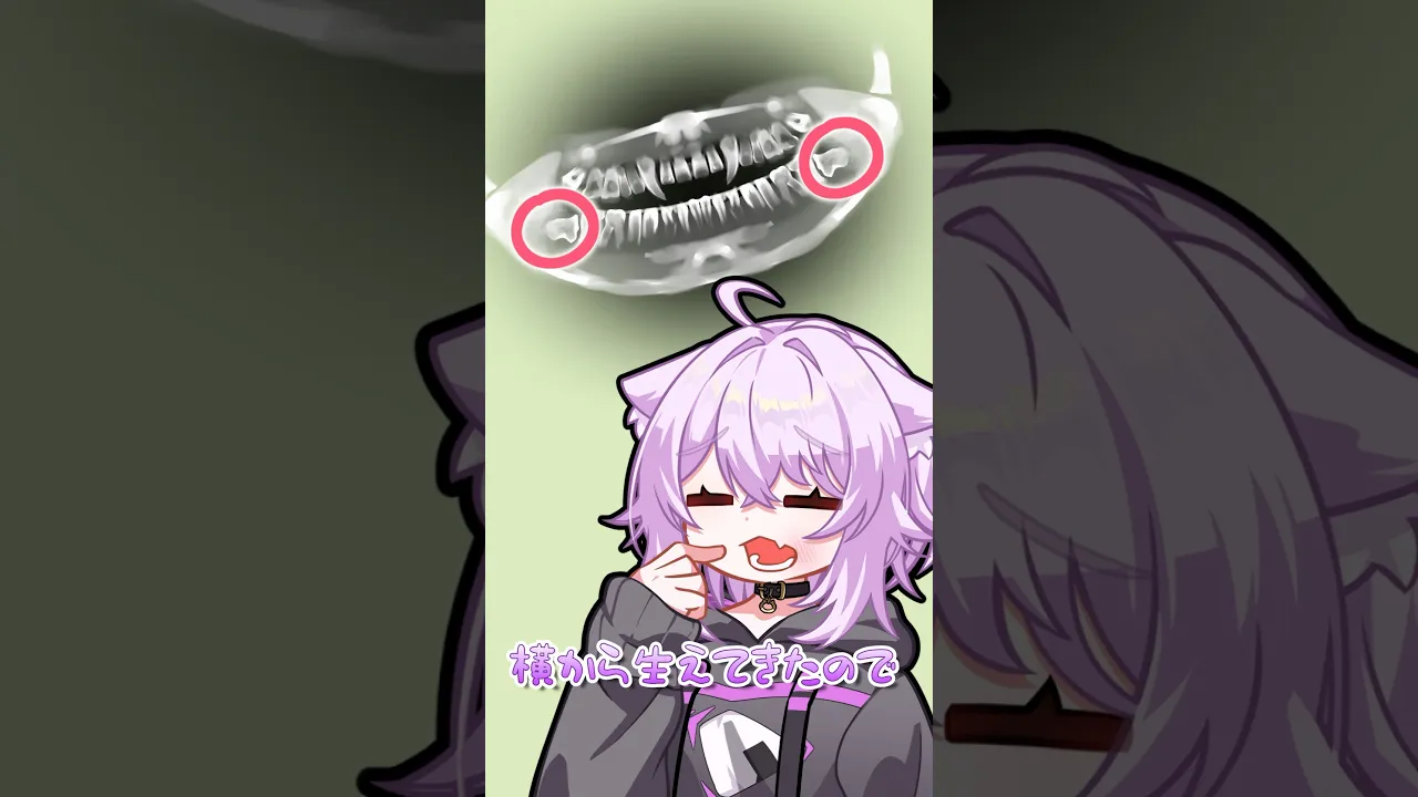 🦷🦷🦷 #vtuber  #shorts  #猫又おかゆ  #親知らず  #歯医者