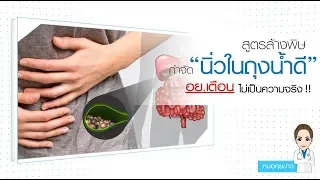 สาเหตุหลักที่ทำให้เกิดนิ่วในถุงน้ำดีมีอะไรบ้าง และปัจจัยเสี่ยงใดที่สำคัญที่สุด