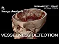 Open Inventor Toolkit Medical Edition Advanced Image Analysis