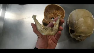 VÍDEO AULA PRÁTICA ANATOMIA ÓSSEA DA CABEÇA PARTE 1