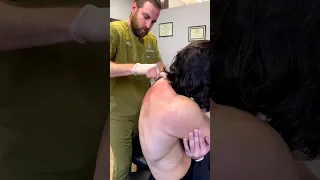 Would You Try Muscle Scraping Hurts So Good