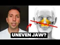Download Lagu This is the REAL cause of facial asymmetry (and uneven Mewing)