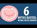 Download Lagu 6 Mitral Valve Surgery Myths Busted!