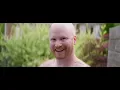 Like Pacific "Self Defeated" (Official Music Video)