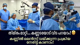 കണ്ണടയോട് വിട പറയാം! 🤩 കണ്ണിൽ ലെൻസ് വയ്ക്കുന്ന പ്രക്രിയ നേരിട്ട് കാണാം | Cataract Surgery