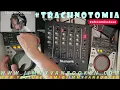 #trachnotomia 075 (22/OCT/2026) #oftenmissbeat