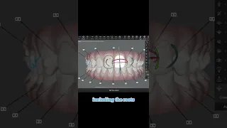 How Invisalign works An orthodontist s smile design modification using Clincheck software 2023