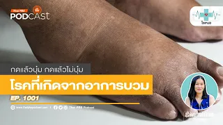 ทำไมการกินอาหารเค็มจึงทำให้บวมได้