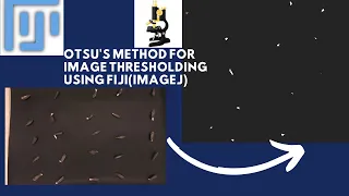 How do you do thresholds in ImageJ Otsu thresholding image binarization