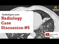 Hemoptysis - Role of Imaging Case-based approach Radiology Board Review Case