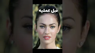 أفشل عمليات التجميل راح تنصدمون من الأشكال  أفشل عمليات التجميل راح تنصدمون من الأشكال