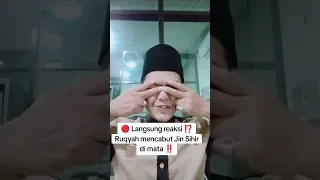  langsung reaksi ruqyah mencabut jin sihir di mata paling ampuh 