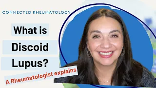 Download What is Discoid Lupus A Rheumatologist explains MP3