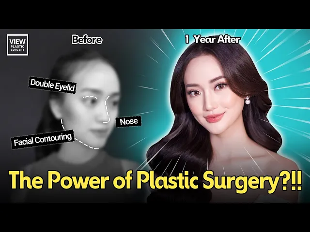 The Power of Plastic Surgery?! Facial Contouring, Rhinoplasty, and Double Eyelid Surgery in Korea 🇰🇷