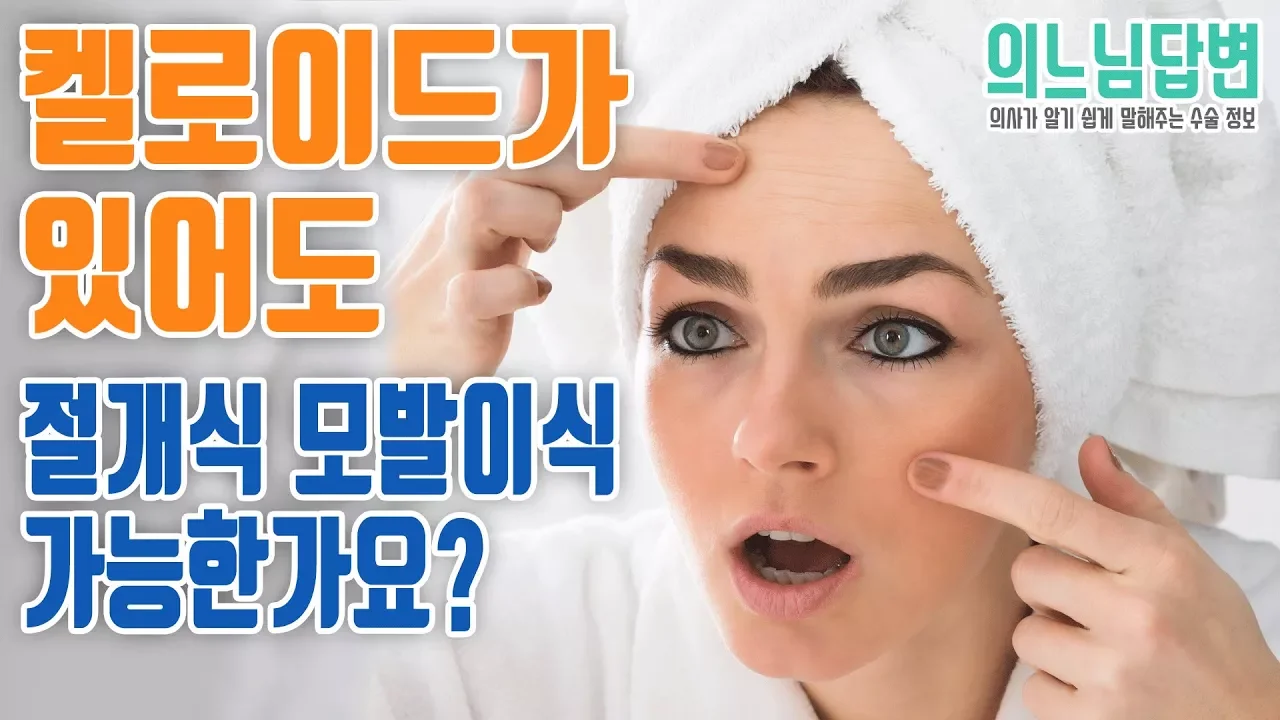 의느님답변📂ㅣ의느님 답변 35회, 켈로이드가 있어도 절개식 모발이식이 가능한가요?