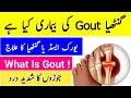 Download Lagu What Is Gout (arthritis) Urdu Hindi - Uric Acid Diet Urdu Hindi - Irfan Azeem