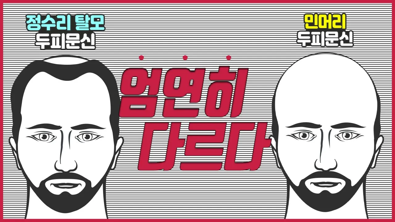 의느님답변📂ㅣ정수리탈모 두피문신,민머리 두피문신 이 둘은 개념 자체가 다릅니다.