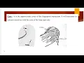 How to select Core and Delta Rules Fingerprint Classification