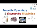 Download Lagu Amebiasis (Amoebic Dysentery) | Entamoeba histolytica, Pathogenesis, Signs \u0026 Symptoms, Treatment