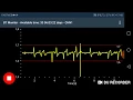 Android real time bluetooth monitor