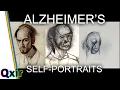 Artist With Alzheimer's Disease Draws Himself as Condition Progresses