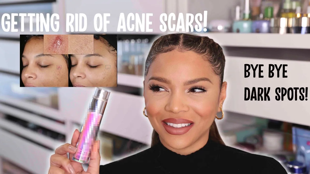 L'Oreal Paris Youth Code Dark Spot Serum Corrector Review