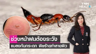 อาการที่เกิดจากพิษแมลงก้นกระดกมีอะไรบ้าง