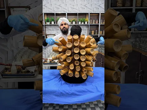 Chinese Bamboo Cupping Therapy Benefits | A New Traditional Cupping Experience in Pakistan Dr Usman