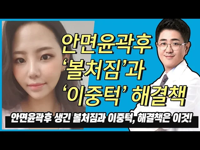 안면윤곽 볼처짐과 이중턱없애는방법 바로 이것!