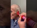 Download Lagu It’s what we do best, custom hearing aids 🤩 #rochesterny #audiologist #oddlysatisfying