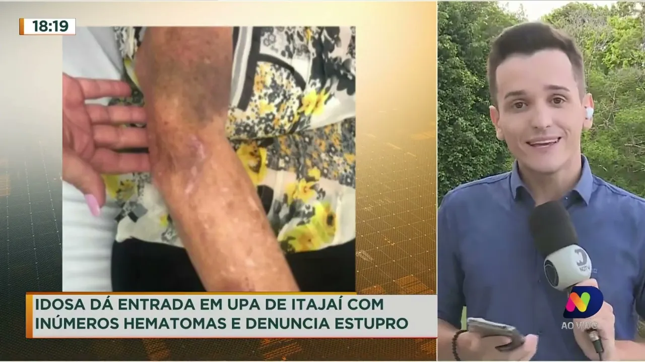 Idosa dá entrada em UPA de Itajaí com inúmeros hematomas e denuncia estupro