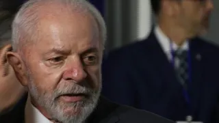 Lula teve o dreno intracraniano retirado | AFP