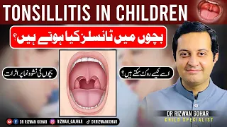 Download Tonsillitis in Children: Dr Rizwan Gohar's Exclusive Tips to Treat It #Tonsillitis #treatment MP3