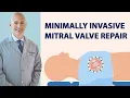 Download Lagu Surgeon Q\u0026A: Minimally-Invasive Mitral Valve Repair with Dr. Marc Gerdisch